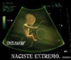 NACHO XT