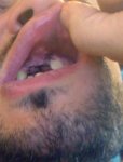 boca rota.jpg