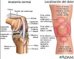Rodilla y dolor.jpg