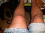 rodilla.jpg