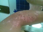 brazo.jpg
