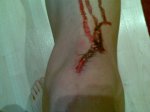 rodilla.jpg