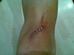 rodilla1.jpg