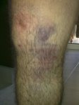 rodilla jesus.jpg