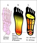 300px-PF-PainAreas.jpg