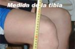 8ZD_medida-de-la-tibia.jpg