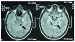 151v52n12-13145809fig3.jpg