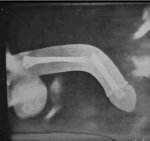 radiografia_pene.jpg