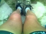 rodilla..jpg