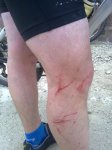 heridas de guerr&#9.jpg