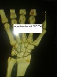 mano 2 - copia..jpg