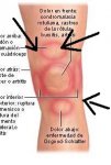 dolor-de-rodilla.jpg