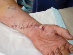 hope-hand-stich.jpg