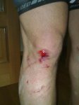 rodilla.jpg