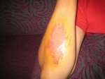 brazo 001.jpg