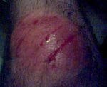 Rodilla(1).jpg