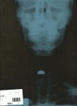 radiografia 001.jpg