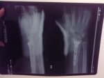 radiografia.jpg