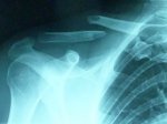 Clavicula.jpg