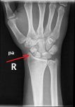 Arm3GpXODXYT5lsd8gxC.0.jpg