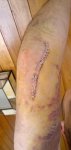 20110201 - Operacion Codo Rafa 1.jpg