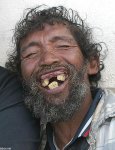 falto de dientes.jpg