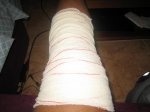 mi rodilla.jpg