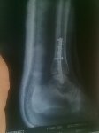 20072011284.jpg