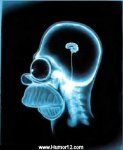 radiografia JORSON.jpg