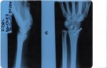 radiografia 1.jpg