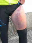 178 Heridas de Jose red.JPG