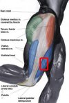 fascia lata.jpg