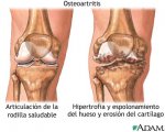 NIH_rodilla-17103.jpg