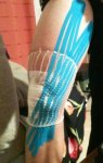 rodilla en reparacion.JPG