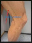 musculos 2.jpg