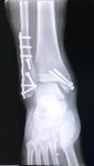 Radiografia.jpg