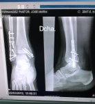 Radiografia 2.jpg