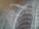 2012-04-30 11.00.01.jpg