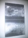 IMG174.jpg
