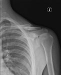 Radiografia1_4-7.jpg
