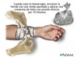 hielo.jpg