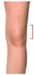 Rodilla.jpg