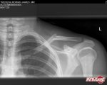 pbpic1092528.jpg
