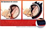 casco22.jpg