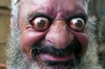 ojos-saltones.jpg