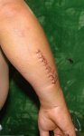 atras-brazo.jpg