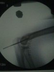 IMG-20130117-WA0008.jpg