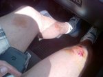 rodilla - copia.jpg