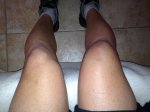 Rodilla 7a.JPG