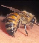 picadura-de-abeja.jpg